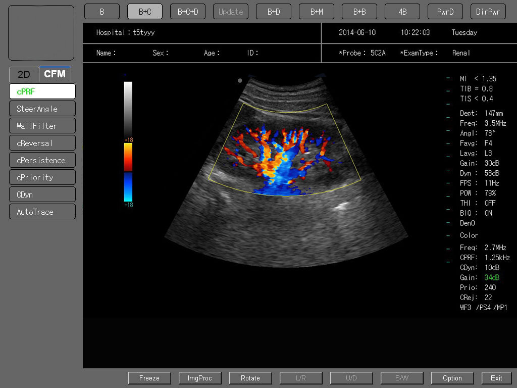 MS-C6600 Colour Doppler Ultrasound Scanner