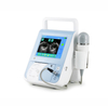 MS-B2100 Bladder Volume Scanner 