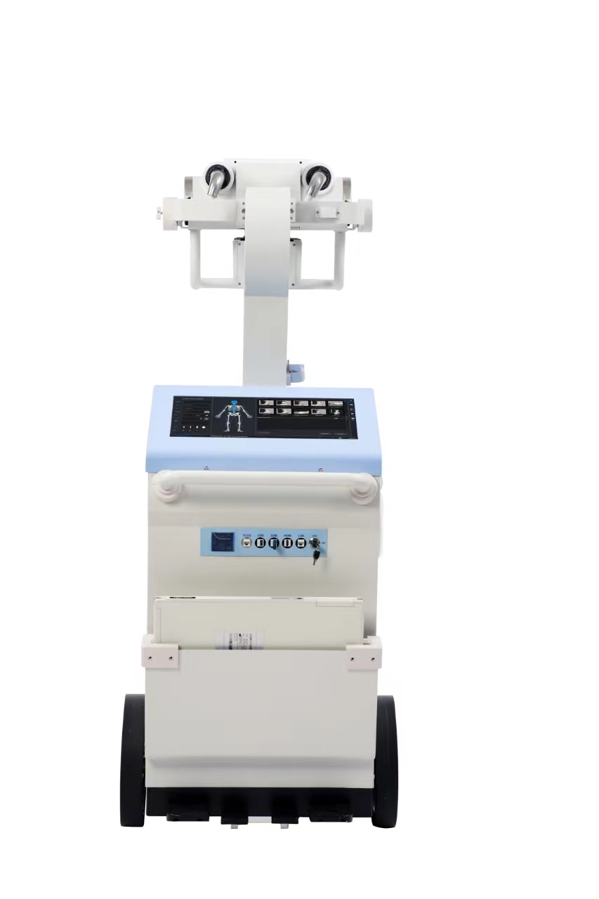Mobile Digital X-Ray Machine 