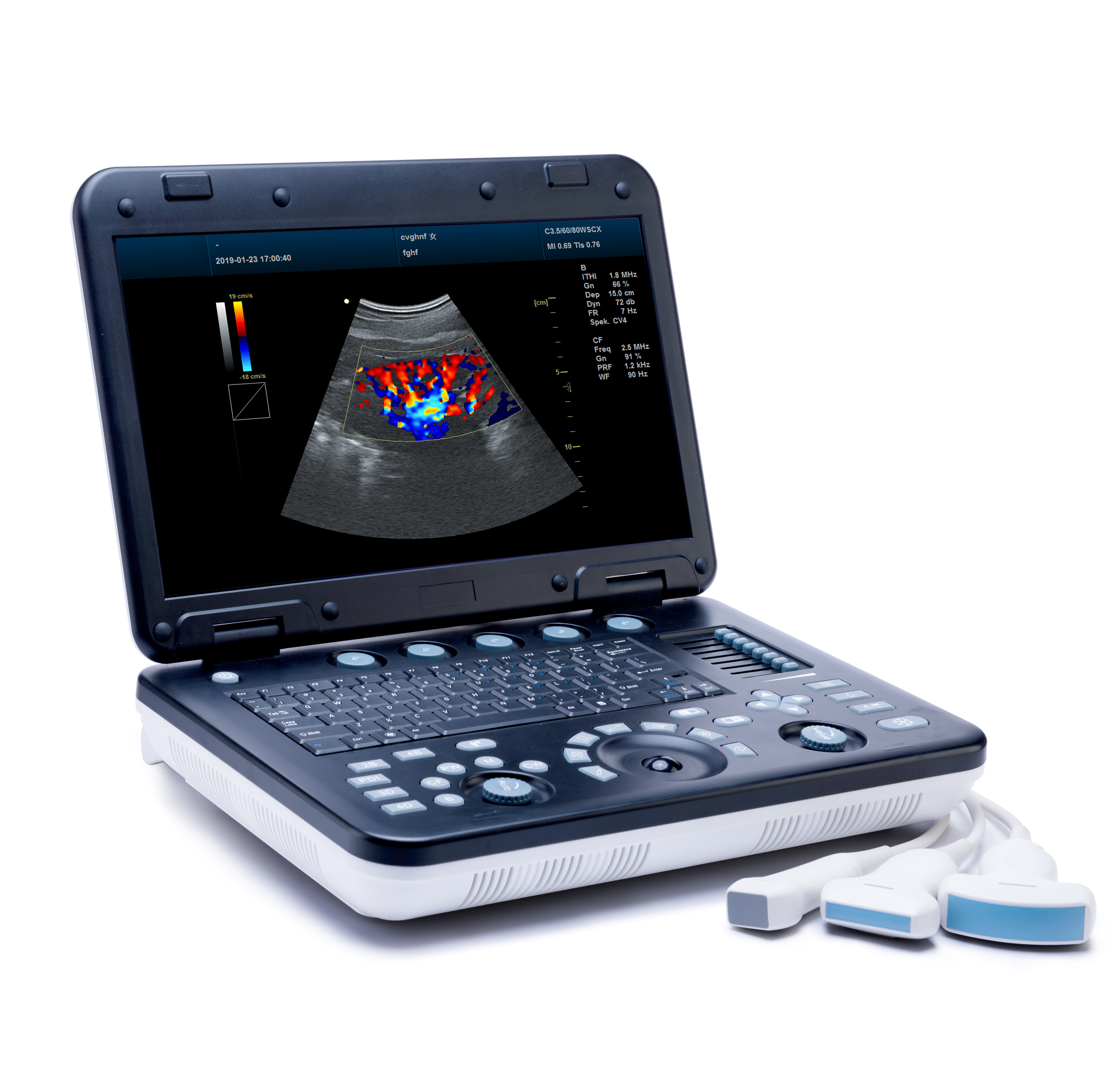MS-C4000 3D 4D Color Doppler Ultrasound Scanner