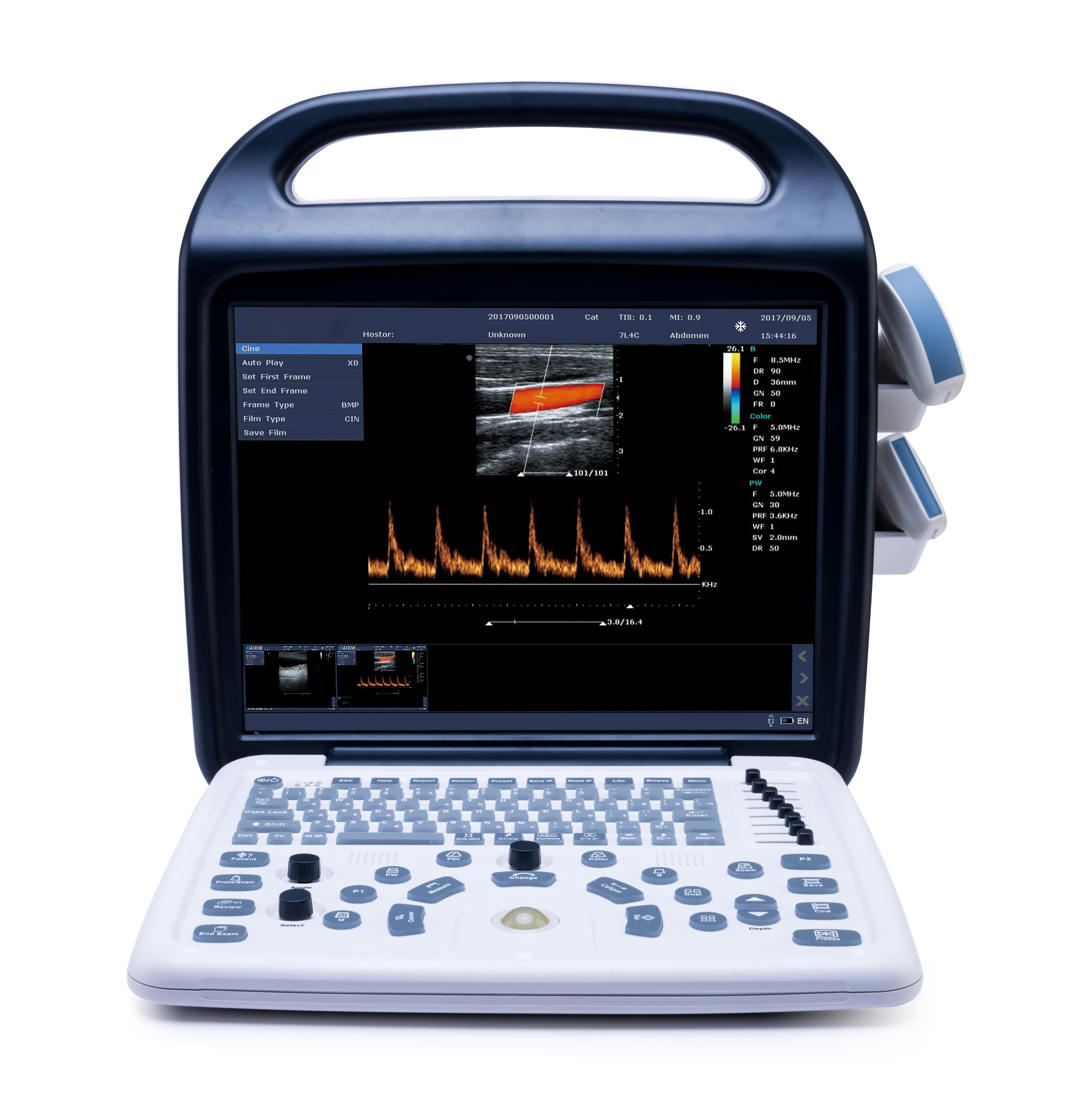 MS-C5800 Portable Color Doppler Ultrasound Machine