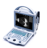 MS-AB5000 Ophthalmic A/B Scan Ultrasound Scanner