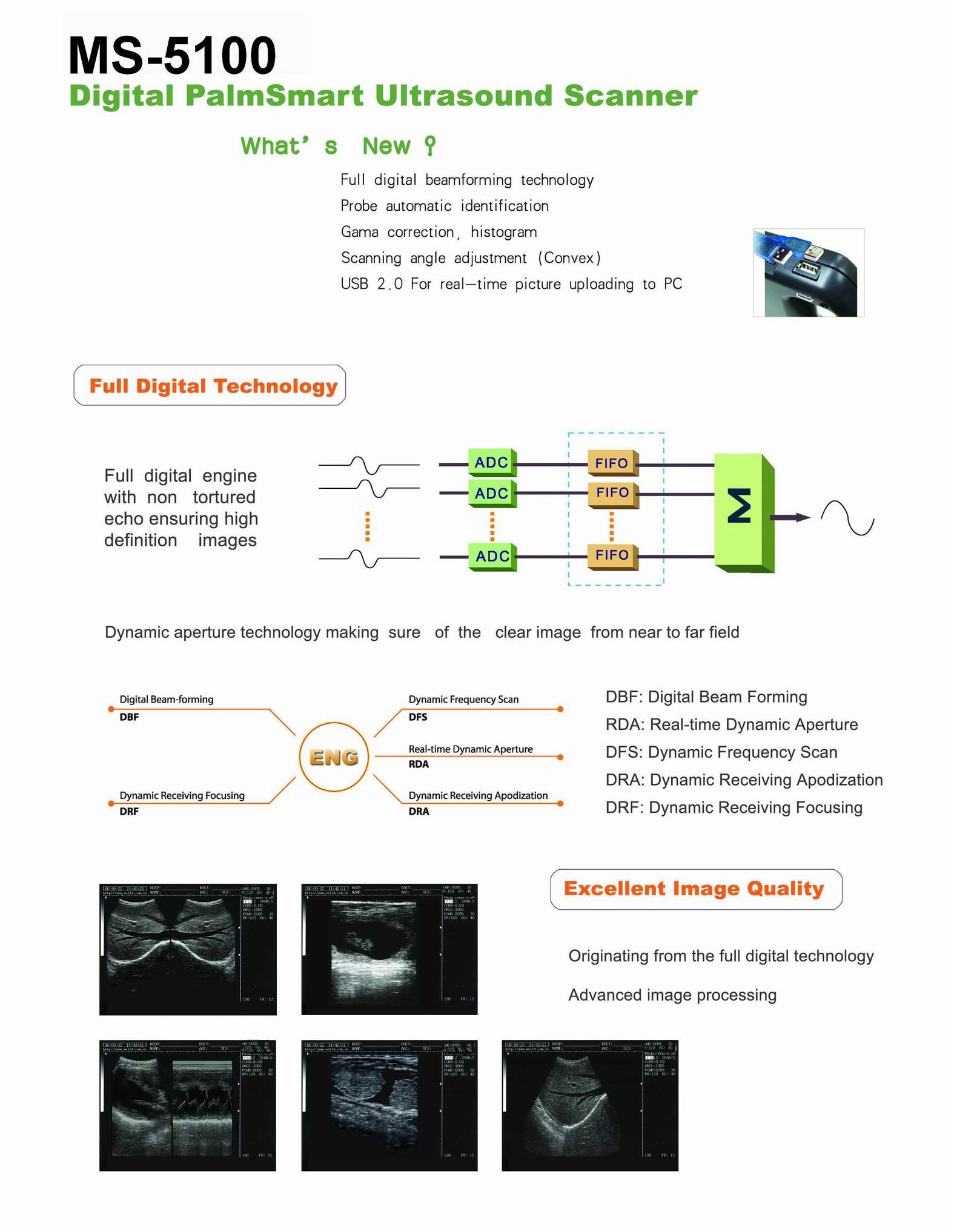 MS-5100 Digital Palm Ultrasound Scanner-3
