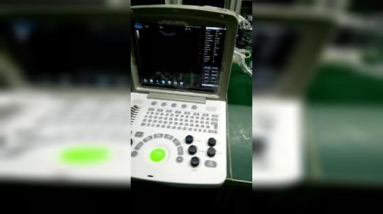 (MS-9000AB) Laptop Portable Fully Digital Ultrasound Scanner Black and White Scanner