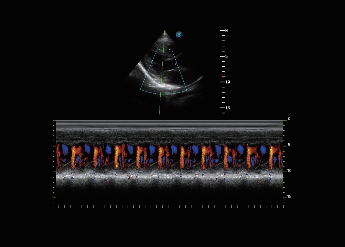 Imatge de la m&agrave;quina d'ecografia Doppler en color del carro SonoScape S11 Plus
