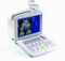 (MS-9000AB) Scanner portable à ultrasons entièrement numérique pour ordinateur portable Scanner noir et blanc