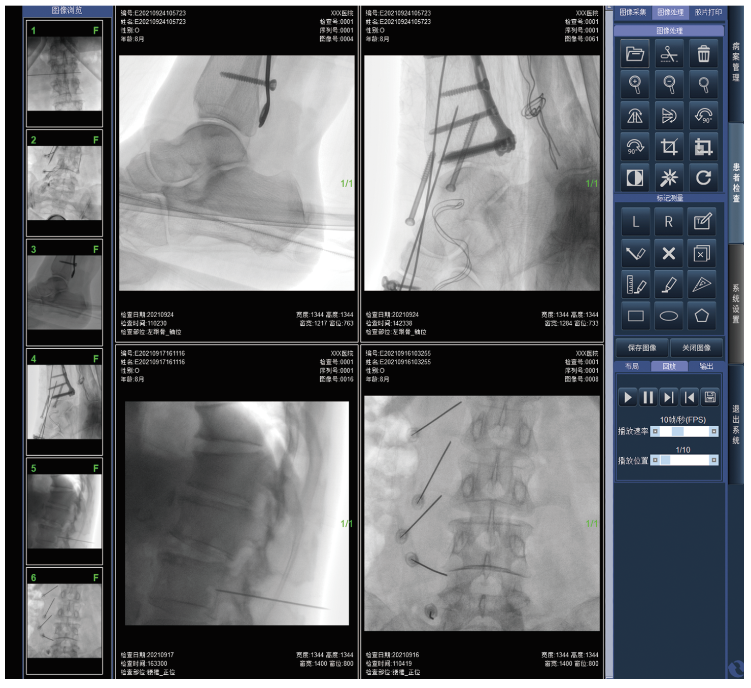 MS-C8800 Mobile FPD C-arm X-Ray Equipment (with laser position)