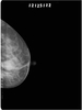 MS-M8500 Mammography System