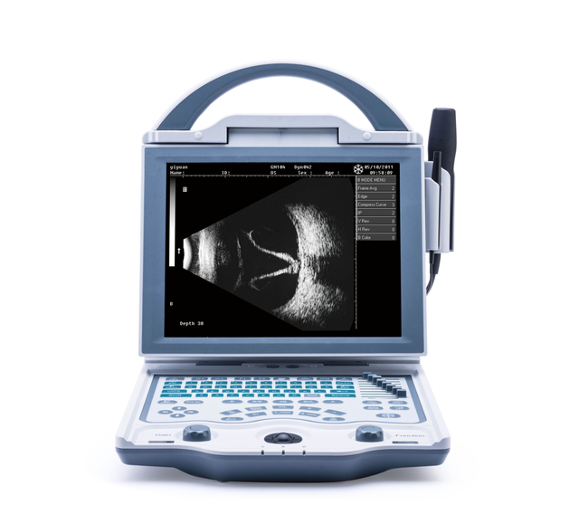 MS-AB5000 Ophthalmic A/B Scan Ultrasound Scanner