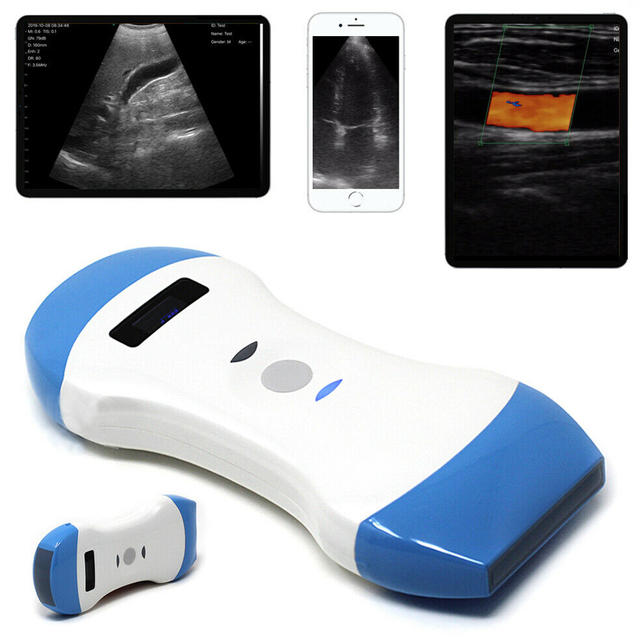 MS-W100 Wireless Probe Color Doppler Ultrasound Scanner