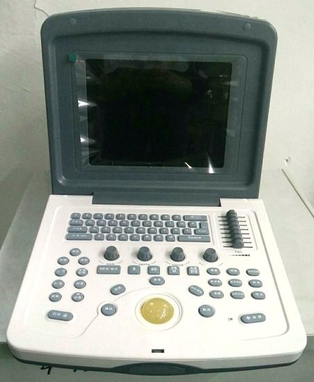 (MS-9000AB) Portátil Escáner de ultrasonido totalmente digital portátil Escáner en blanco y negro