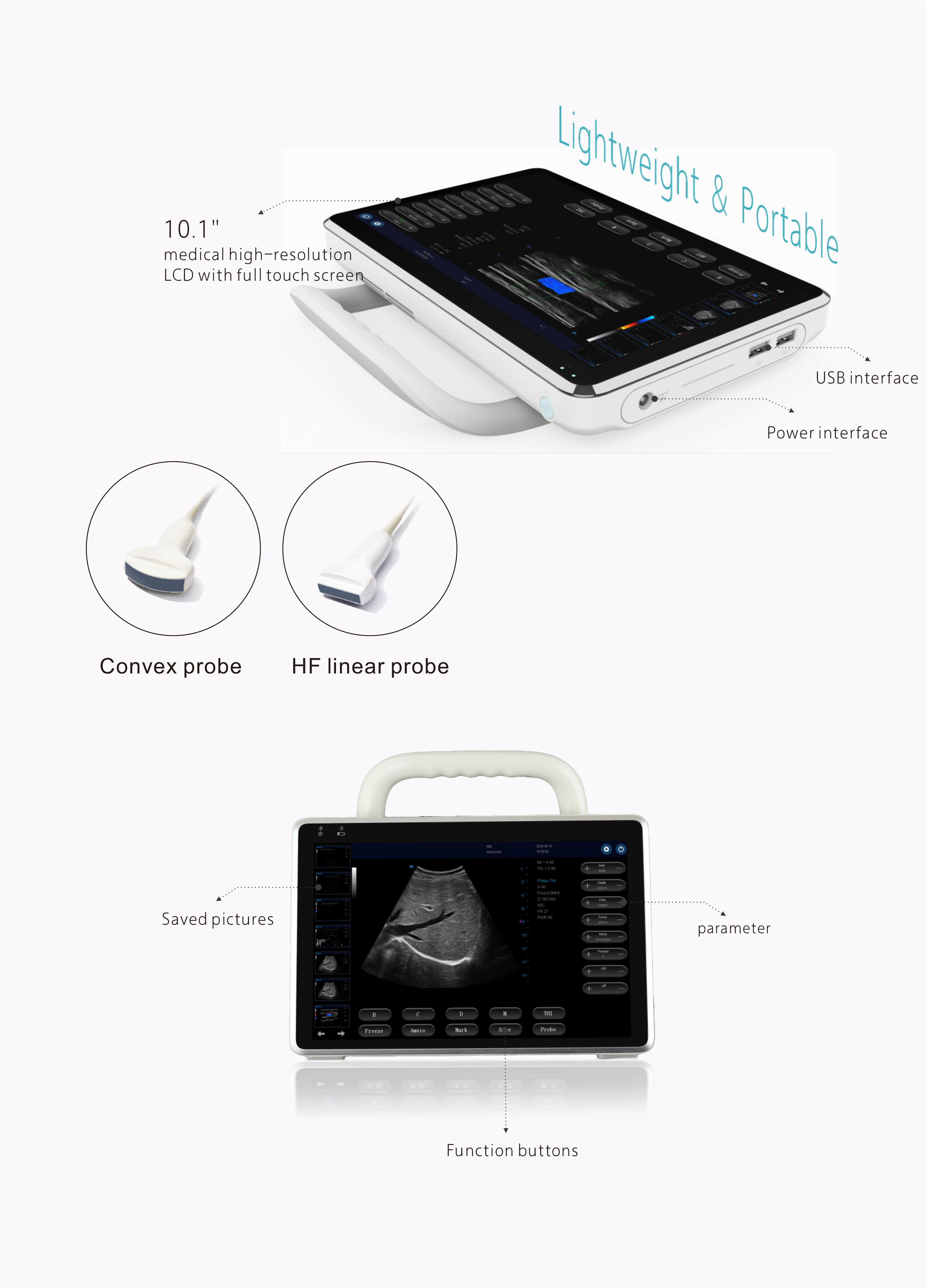 MS-C6000 Portable color Doppler ultrasound diagnostic system