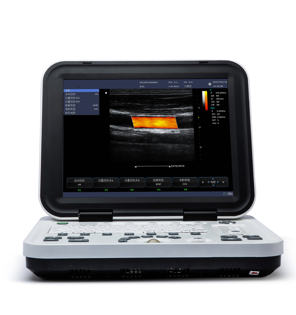 MS-C2200 Full Digital Color Doppler Ultrasonic Diagnostic Instruments
