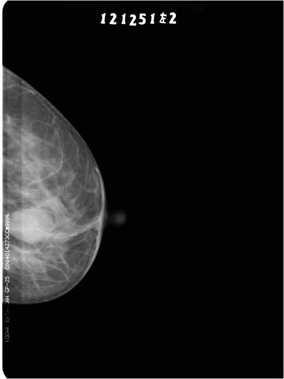 MS-M8300 Mammography System