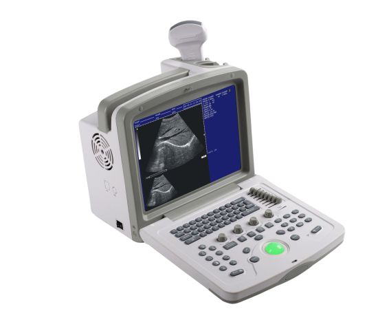 (MS-9000AB) Portátil Escáner de ultrasonido totalmente digital portátil Escáner en blanco y negro