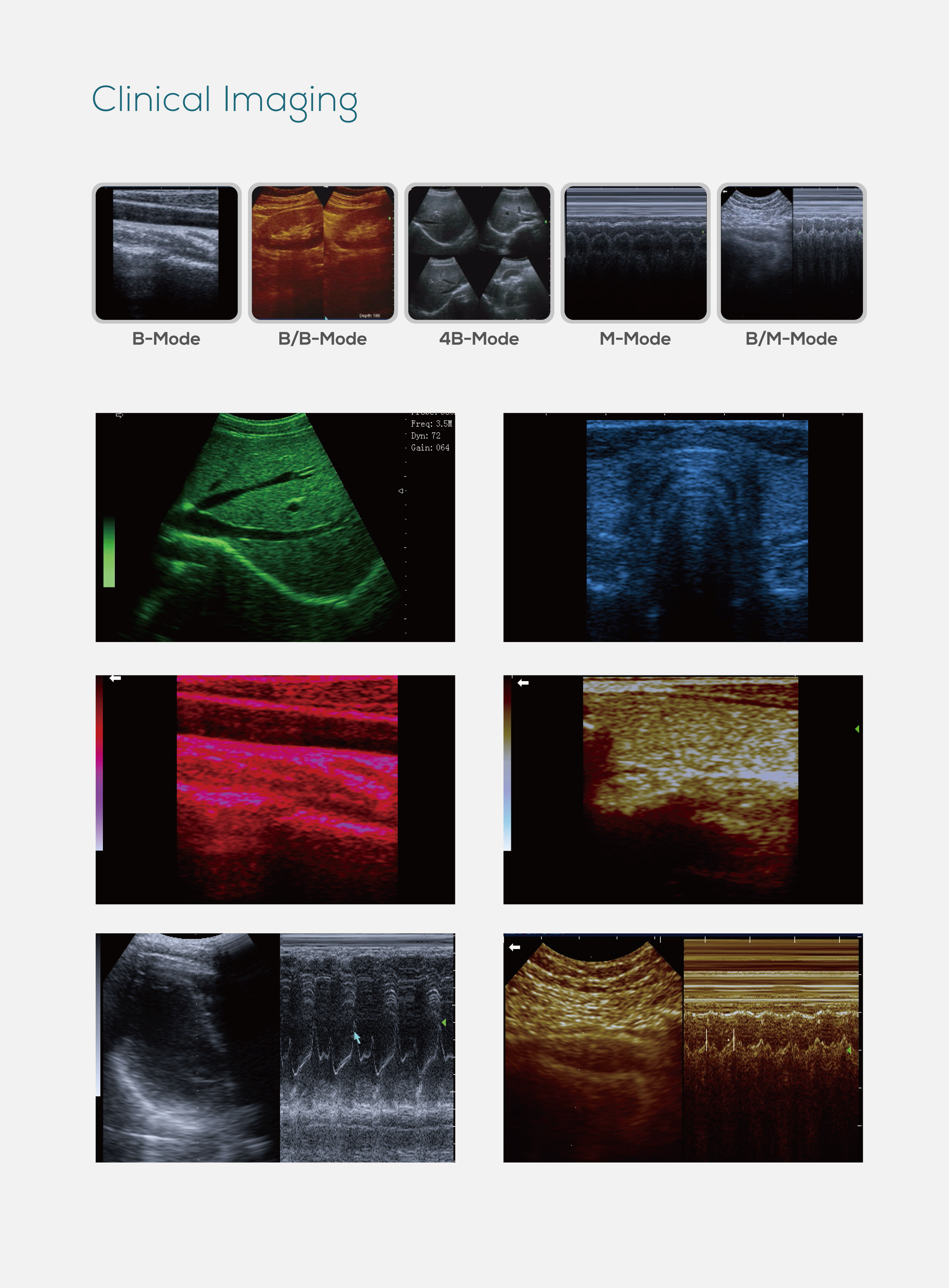 MS-T6600 Doppler Fully Digital black and white ultrasound Diagnostic System