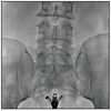 MS-C8800 Mobile FPD C-arm X-Ray Equipment (with laser position)