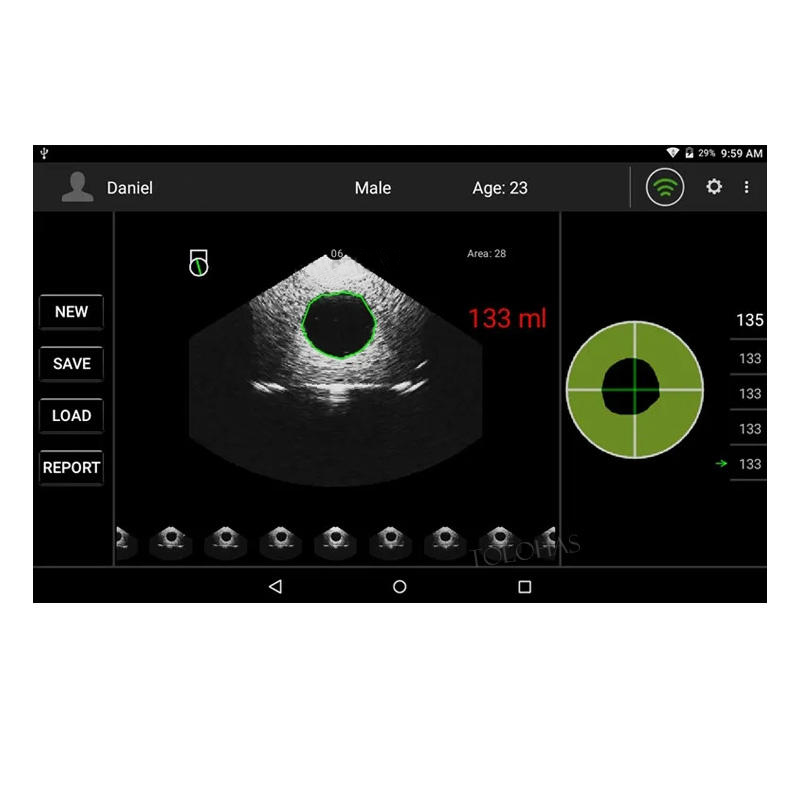 MS-B2600 Bladder Scanner