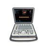 MS-C2800 Full Digital Portable Color Doppler Ultrasound Machine
