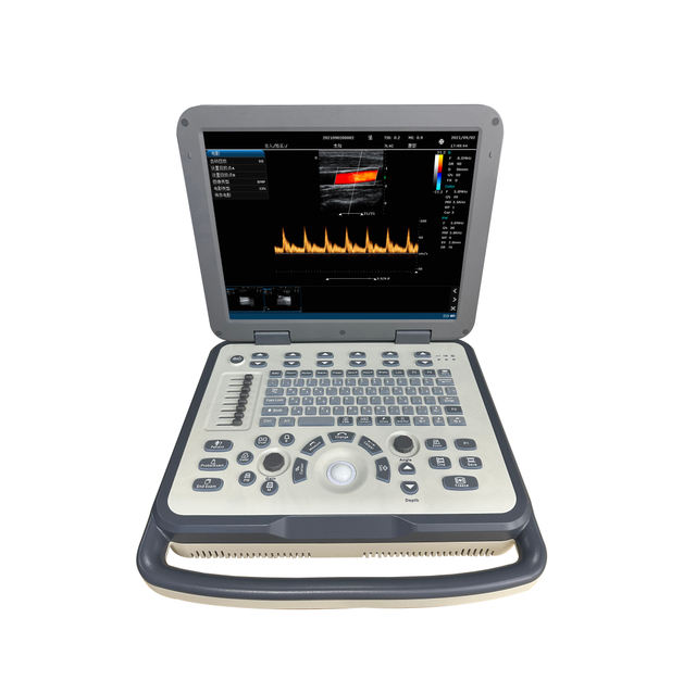 MS-C2800 Full Digital Portable Color Doppler Ultrasound Machine