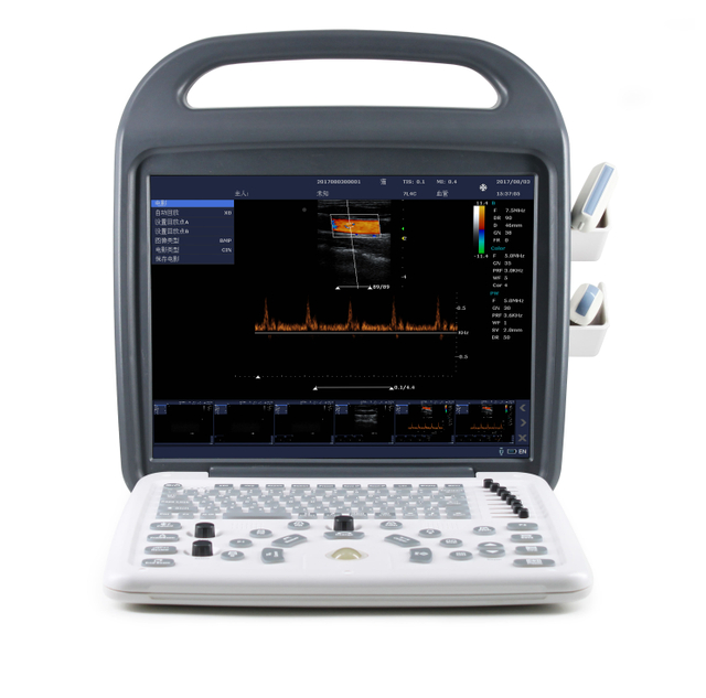 MS-C5800 Portable Color Doppler Ultrasound Machine