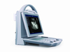 MS-P1000 Portable Full Digital Ultrasound Scanner