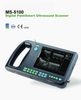 MS-5100 Digital Palm Ultrasound Scanner 
