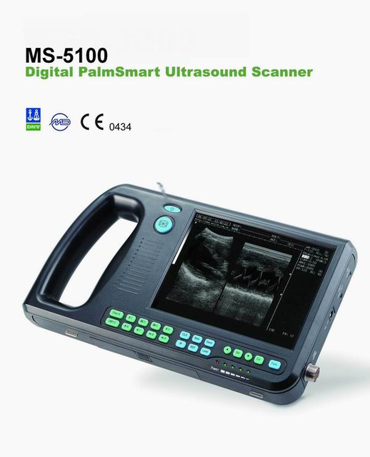 MS-5100 Digital Palm Ultrasound Scanner 