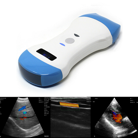 Portable Wireless Probe Type Color Doppler Ultrasound Scanner Ms