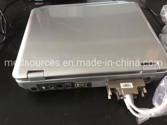 (MS-4500) Portable Laptop Scanner Full Digital 3D 4D Echo Color Doppler Ultrasound Scanner