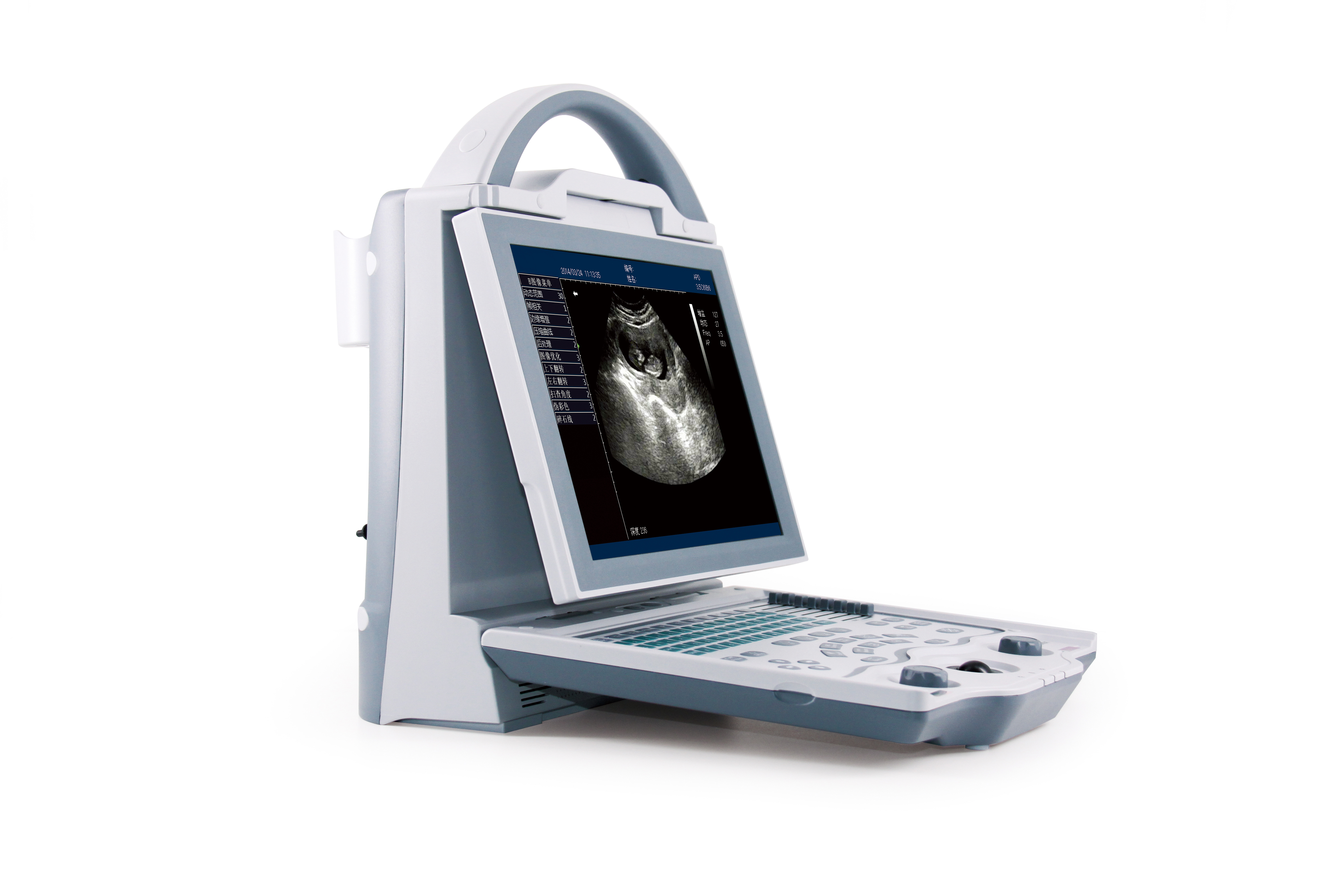 MS-P1000V Veterinary B Mode Ultrasound Scanner
