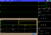  PM500-30 Multi-parameter Patient Monitor