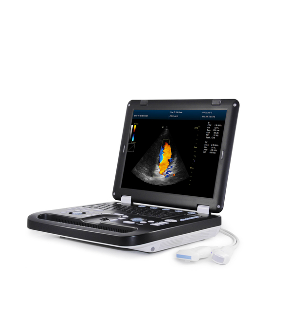 MS-C3000 Color Doppler Ultrasound Scanner·Large screen display