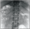 MS-C8800 Mobile FPD C-arm X-Ray Equipment (with laser position)