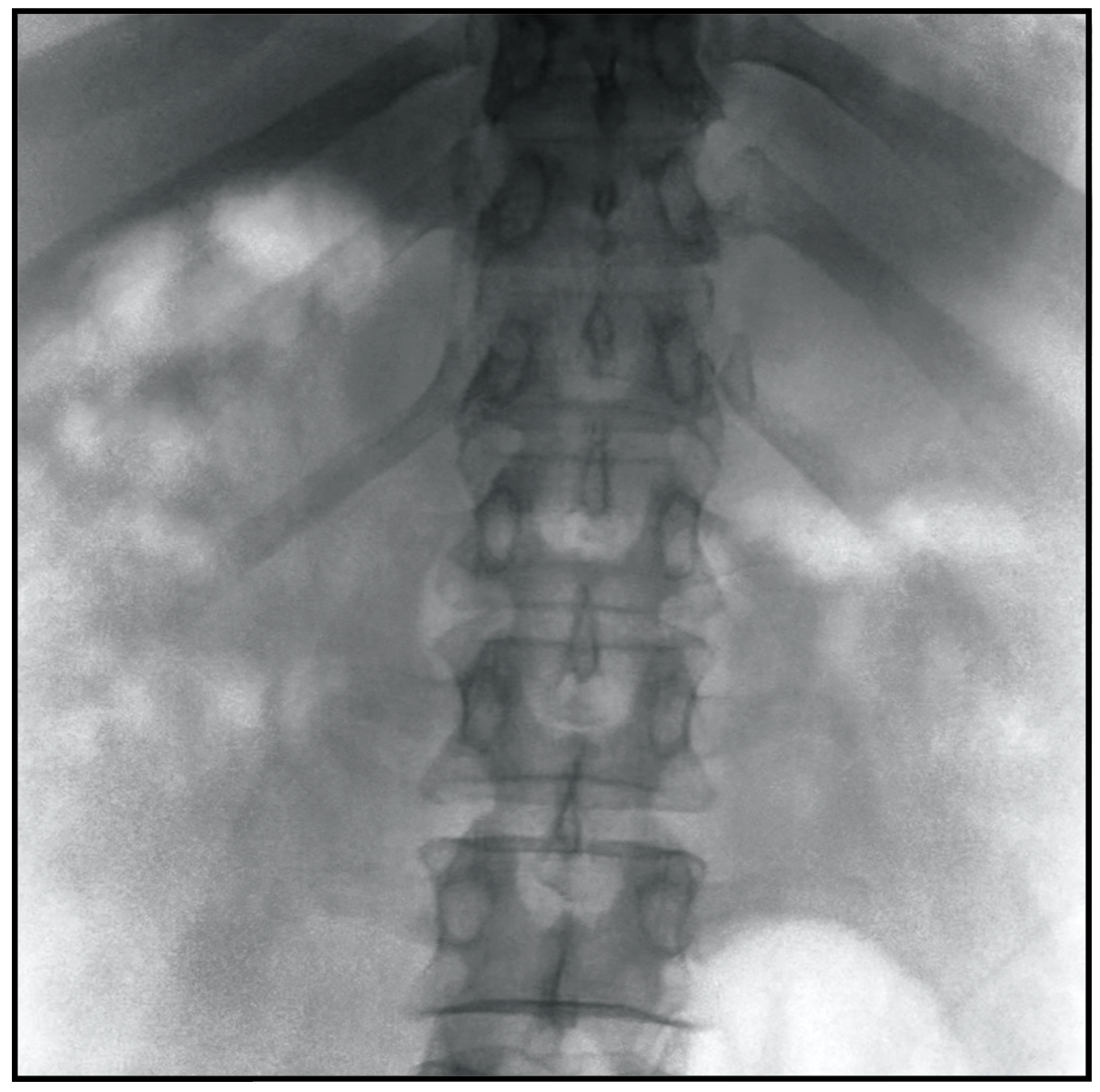 MS-C8800 Mobile FPD C-arm X-Ray Equipment (with laser position)