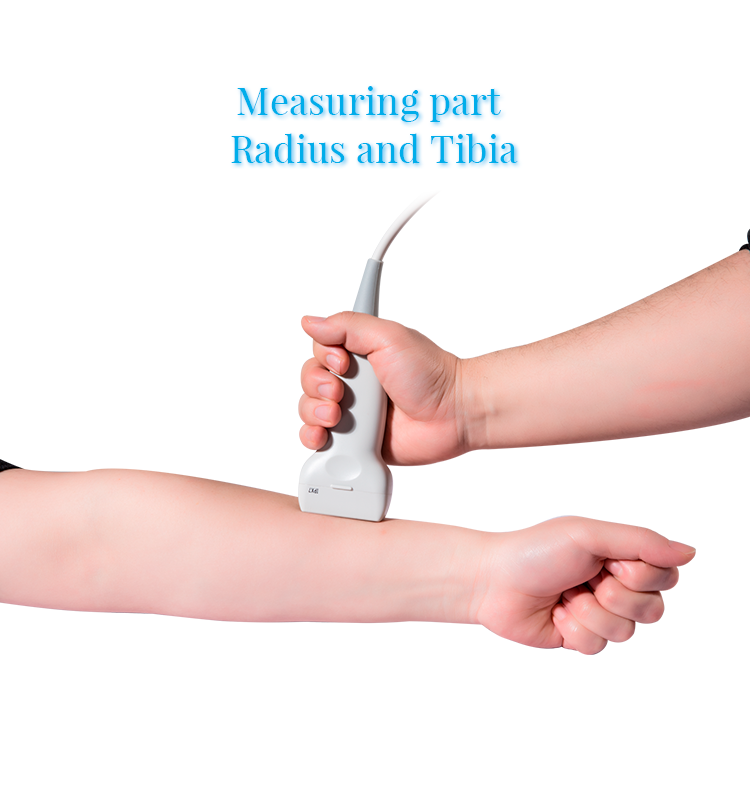 Portable Ultrasound Bone Densitometer