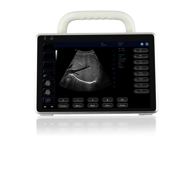 MS-C5500 Portable color Doppler ultrasound diagnostic system