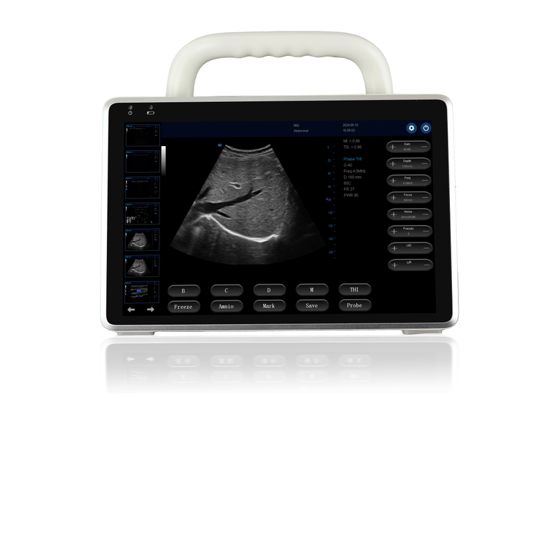 MS-C6000 Portable color Doppler ultrasound diagnostic system