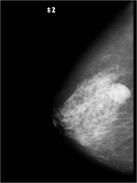 MS-M8300 Mammography System